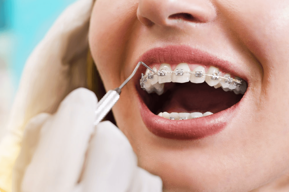 Pediatric Dentistry