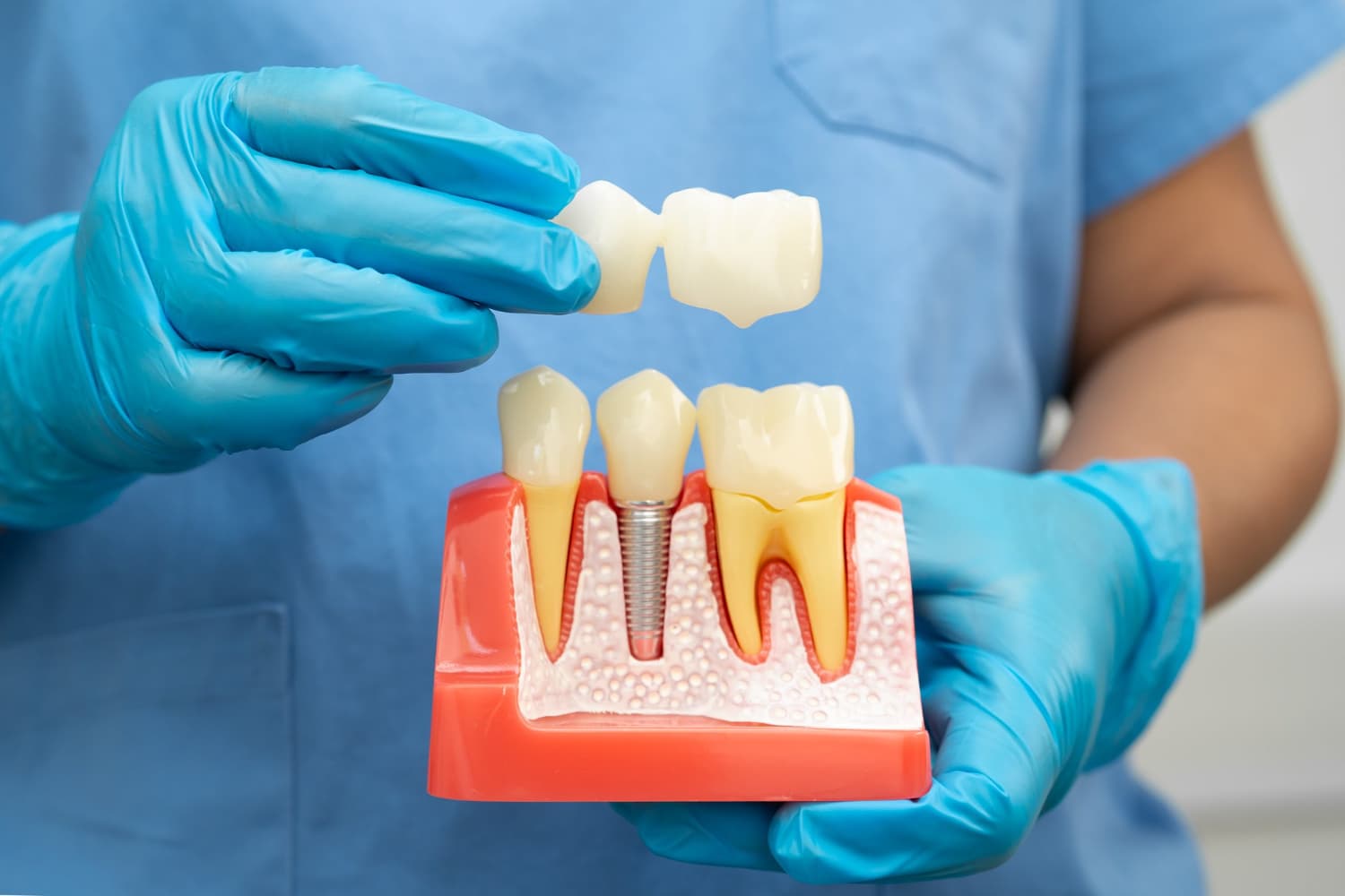 Common Dental Problems We Treat